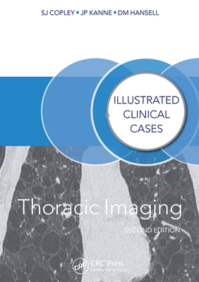 Read Online Thoracic Imaging: Illustrated Clinical Cases, Second Edition - Sue Copley | PDF