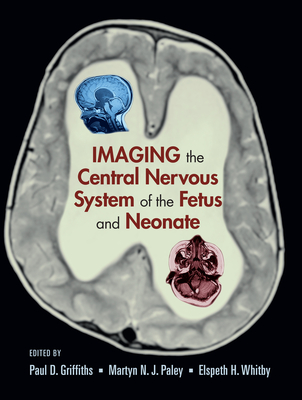 Download Imaging the Central Nervous System of the Fetus and Neonate - Paul D. Griffiths | PDF