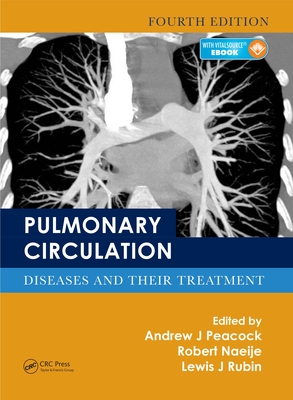 Full Download Pulmonary Circulation: Diseases and Their Treatment, Fourth Edition - Andrew J. Peacock file in ePub